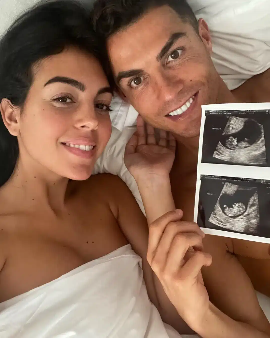Georgina’s Pregnancy Announcement